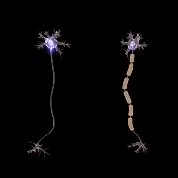 GIF com dois neurônios na vertical. O neurônio a esquerda da imagem está sem bainha de mielina, o brilho que representa o impulso nervoso passa por ele de forma lenta e desordenada. O neurônio a direita está com a bainha de mielina, representada por uma capa que envolve seu corpo. O impulso nervoso passa pela bainha de mielina rapidamente.