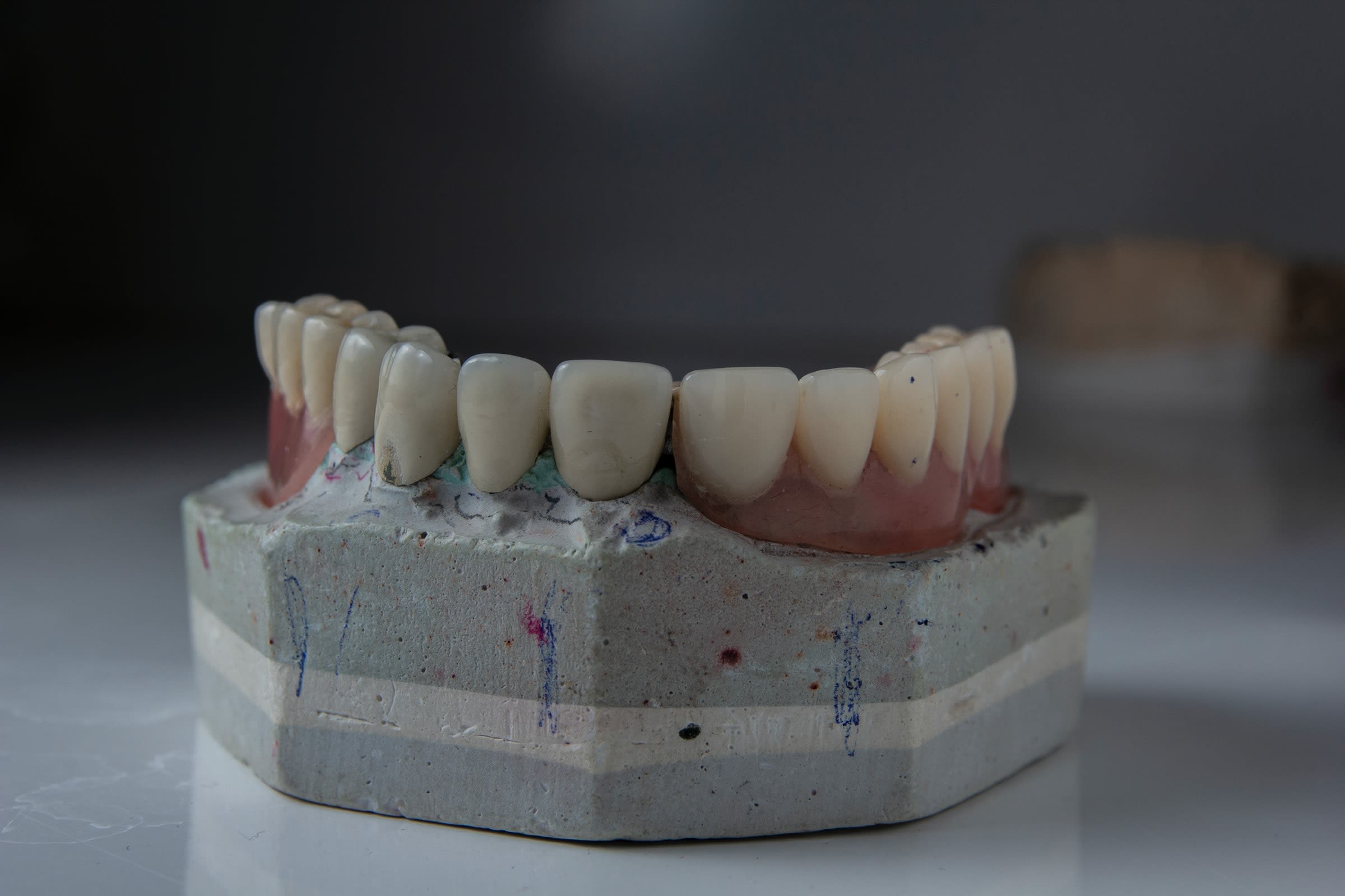 dentures on white scale rack